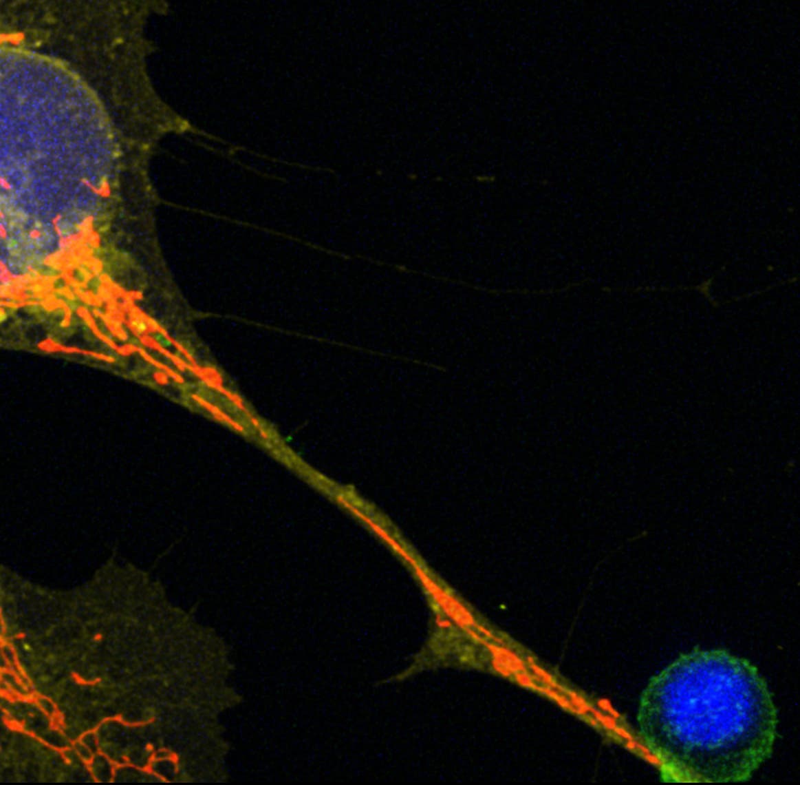  Fluoreszenzmikroskopisches Bild einer Zelle, das die Zellstruktur in verschiedenen Farben zeigt. Der Zellkern ist blau gefärbt, während das Zytoplasma in Rot- und Grüntönen dargestellt ist. Die Bildskala unten links zeigt 20 Mikrometer an. Das Bild hebt die Verteilung und Organisation der Zellbestandteile hervor.