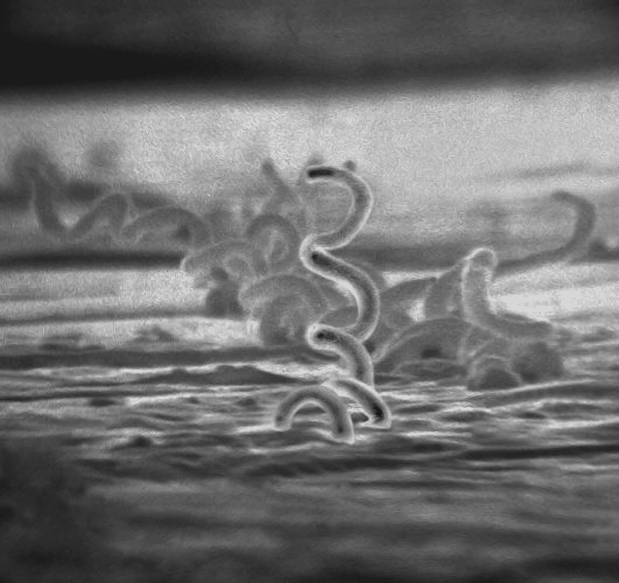 Elektronenmikroskopische Aufnahme von Treponema pallidum