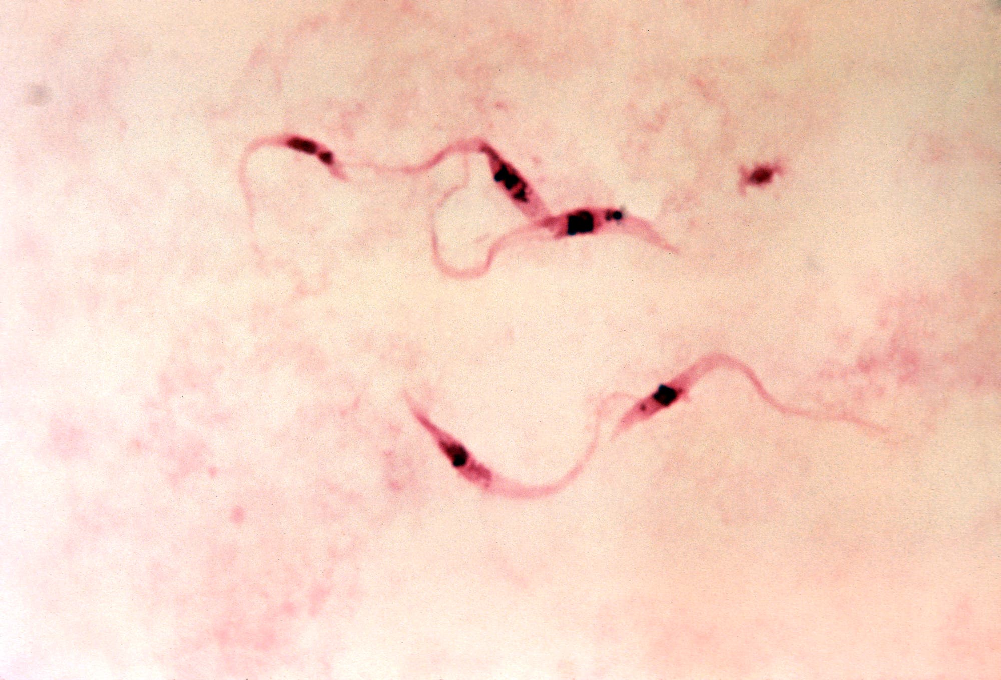 7  Chagas-Krankheit