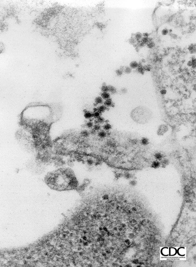West-Nil-Viren isoliert aus einem Krähengehirn