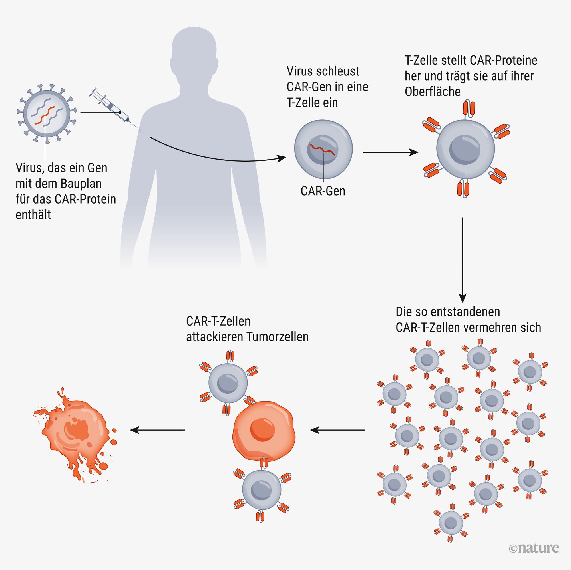Ein Flussdiagramm zeigt den Prozess der CAR-T-Zelltherapie zur Bekämpfung von Krebs. Links oben wird ein viraler Vektor dargestellt, der das CAR-Gen trägt. Der Vektor liefert das Gen an T-Zellen, die daraufhin das CAR-Protein exprimieren. Diese modifizierten T-Zellen vermehren sich und greifen Tumorzellen an. Der Ablauf wird durch Pfeile und beschriftete Schritte verdeutlicht. Oben links ist eine stilisierte menschliche Figur zu sehen, die den Zielorganismus darstellt. Der Text erklärt die Schritte der genetischen Modifikation und die Rolle der CAR-T-Zellen im Kampf gegen Krebs.