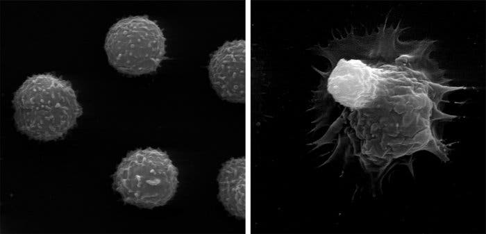 Immunzellen vor und nach der Behanldung