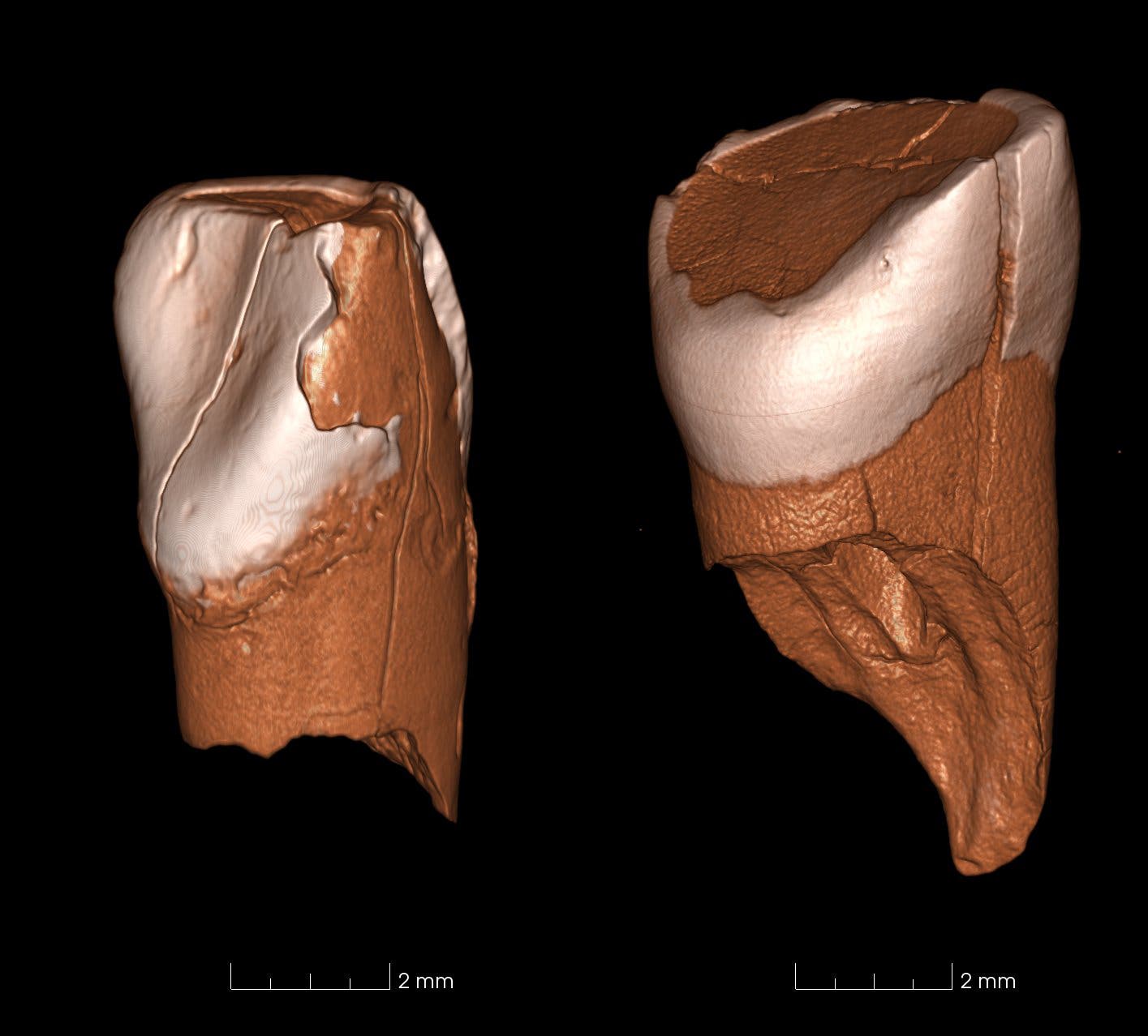 3-D-Rekonstruktion paläolithischer Zähne