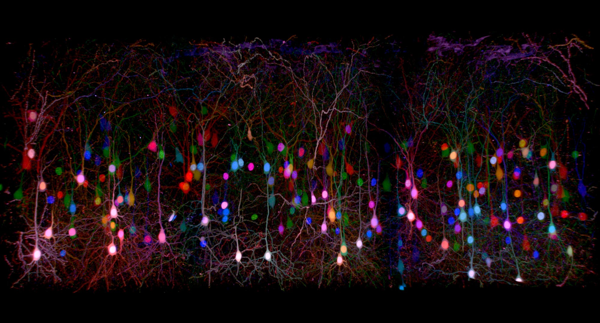 Verästelte Neurone