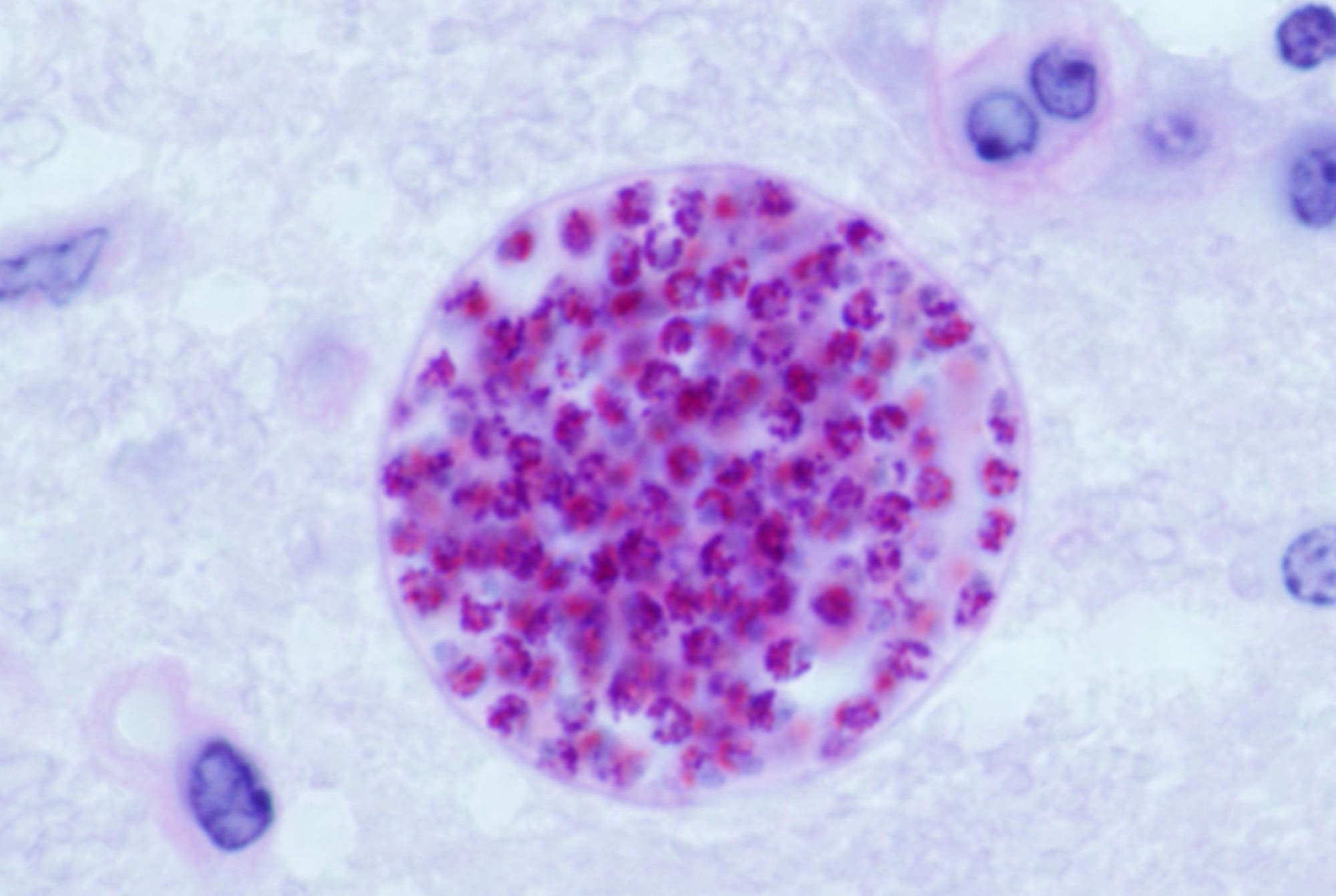 Der Parasit Toxoplasma gondii