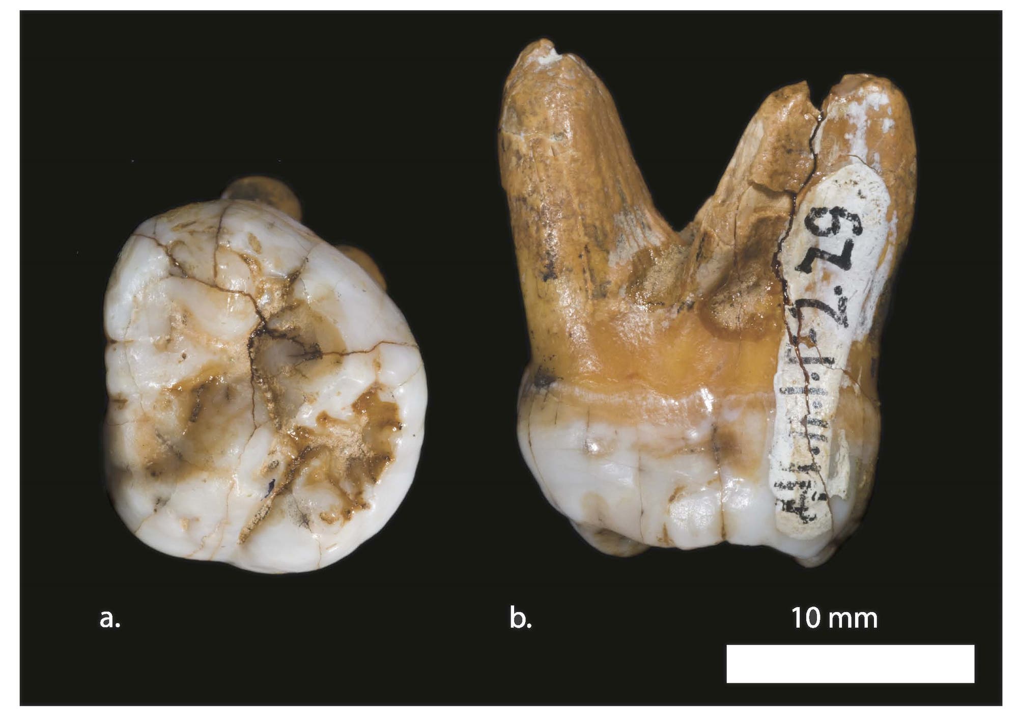 Zahn des Denisova-Menschen