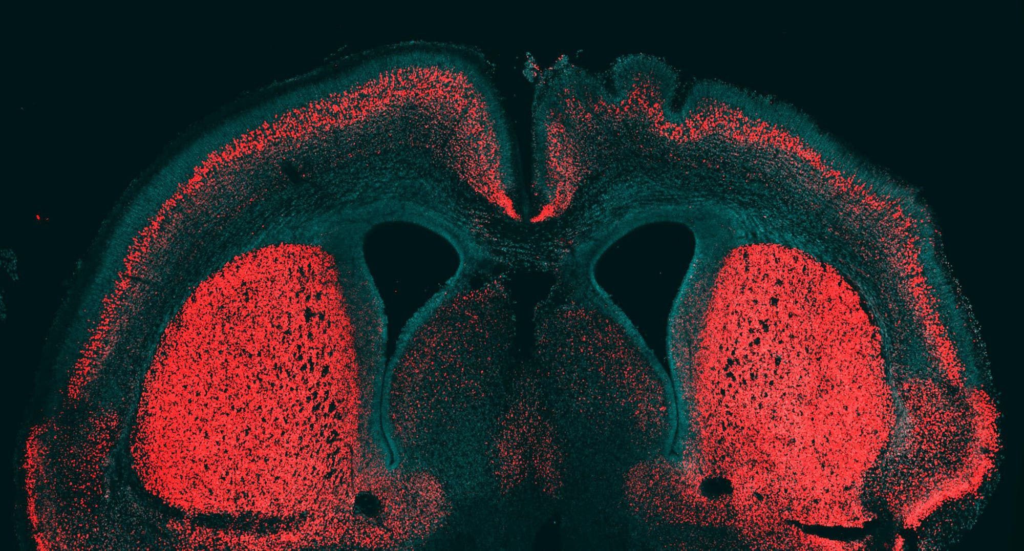 Großhirnrinde eines Mäuseembryos