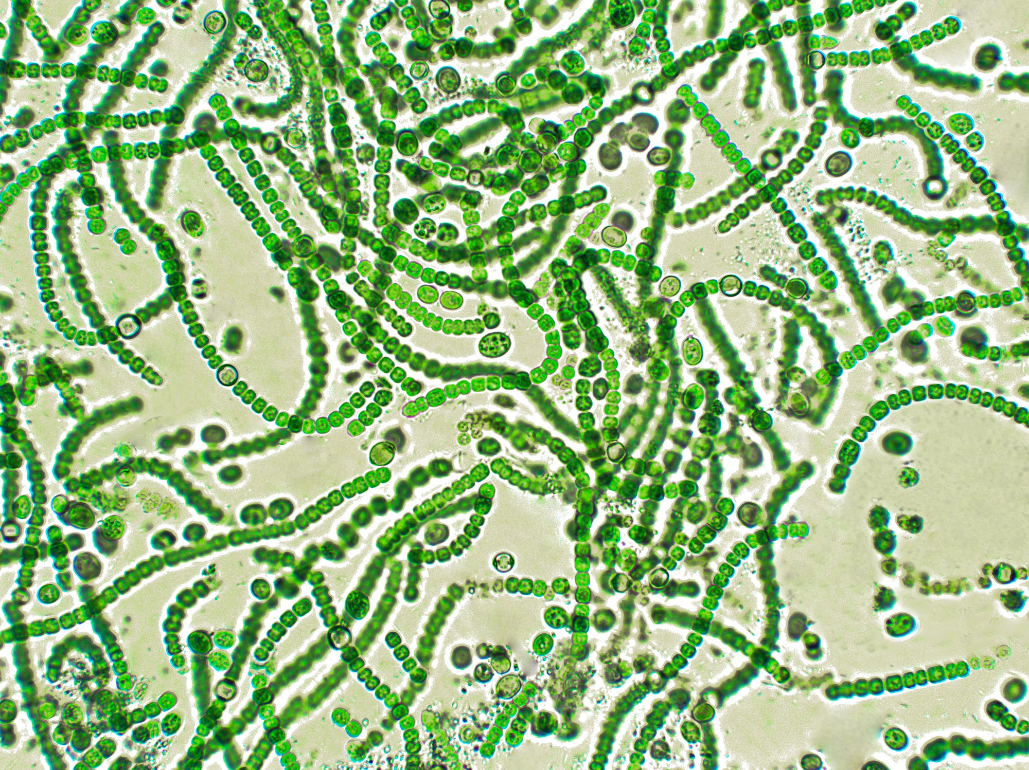 Cyanobakterien