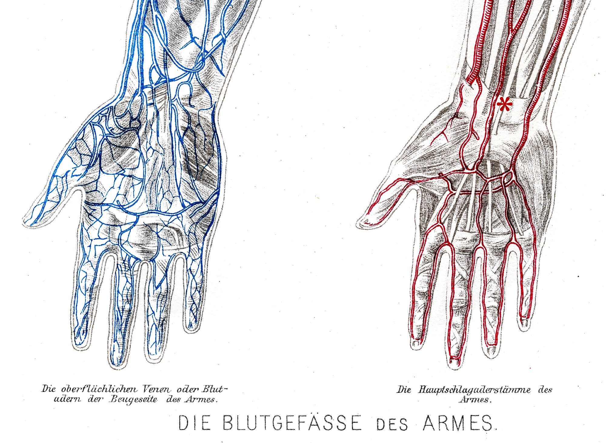 Eine zusätzliche Arterie tritt offenbar immer häufiger auf