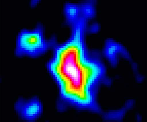 Die Galaxie J1148+5251