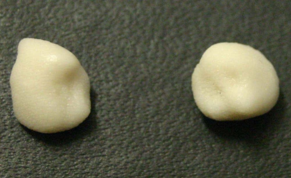 Die Nachbildung der Zähne