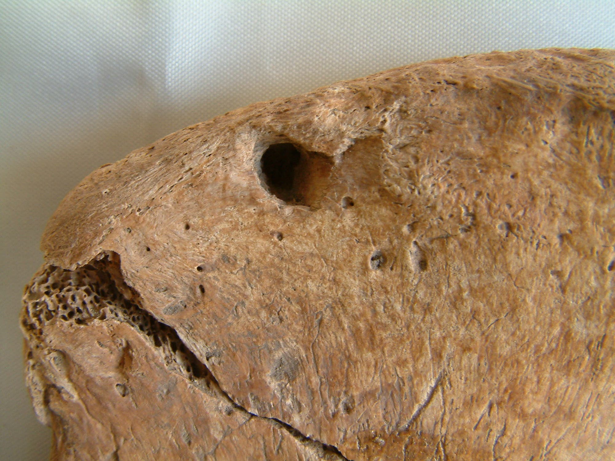 Nahaufnahme eines menschlichen Knochens mit sichtbaren Löchern und einer rauen, texturierten Oberfläche. Der Knochen zeigt Anzeichen von Verwitterung und Alter. Der Hintergrund ist unscharf und neutral, was den Fokus auf den Knochen lenkt.