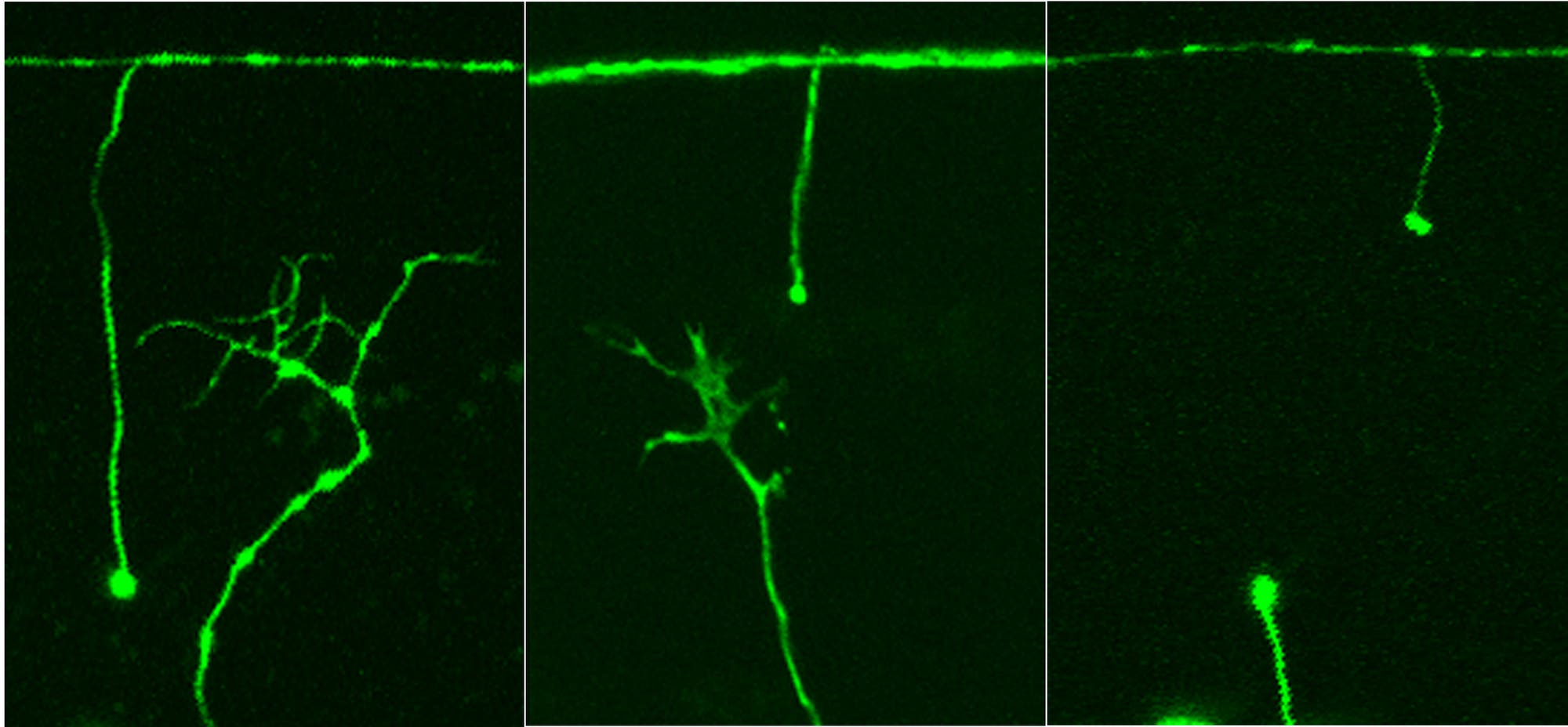 Fadenwurm-Neuronen
