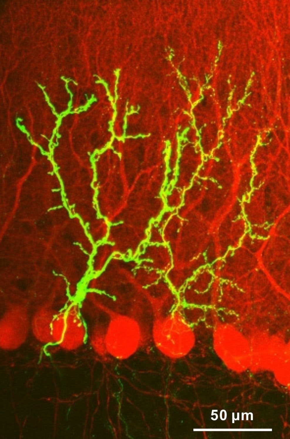 Angefärbte Neurone im Kleinhirn