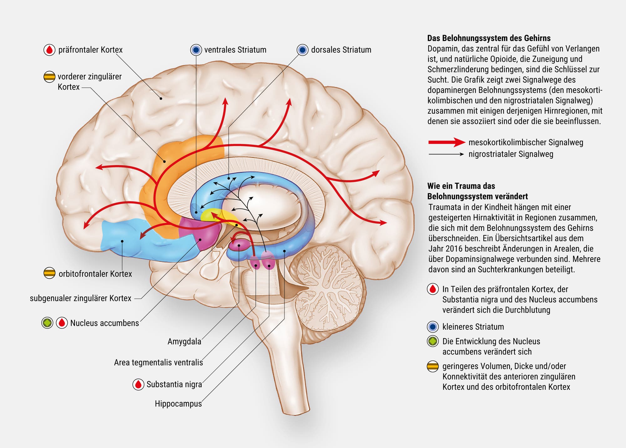 Diagramm des menschlichen Gehirns, das die Auswirkungen von Kindheitstraumata auf das Belohnungssystem und die Suchtentwicklung zeigt. Es hebt verschiedene Hirnregionen hervor, darunter den präfrontalen Kortex, das ventrale und das dorsale Striatum, die Amygdala und den Hippocampus. Zwei Pfade, der mesokortikolimbische und der nigrostriatale, sind dargestellt. Text erklärt, wie Traumata die Aktivität in diesen Bereichen beeinflussen, was zu Suchtverhalten führen kann. Farbige Markierungen zeigen Veränderungen im Blutfluss und in der Struktur bestimmter Hirnregionen.