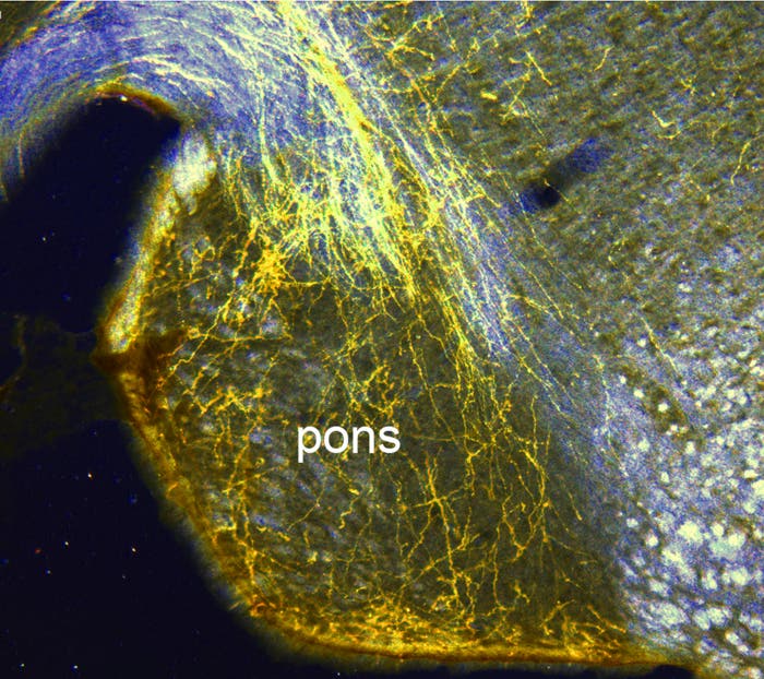 Neuronen aus Stammzellen vernetzen mehrere Hirnteile