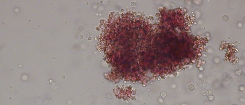 Kolonie von erythrozytären Vorläuferzellen