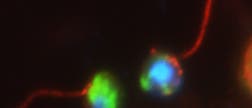 Fluoreszierende Cryptomycota