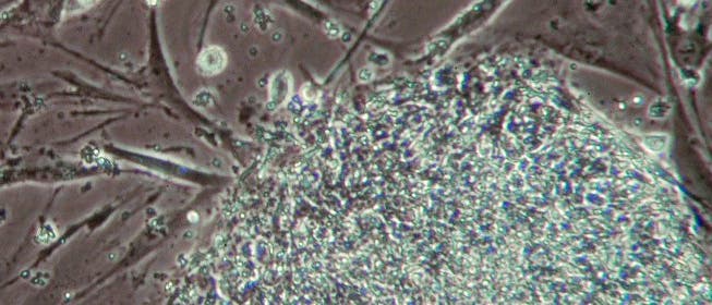 Induzierte Pluripotente Stammzelle