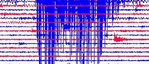 Seismogramm des indonesischen Seebebens