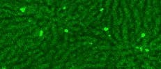 NK-Zellen in Leberkapillaren