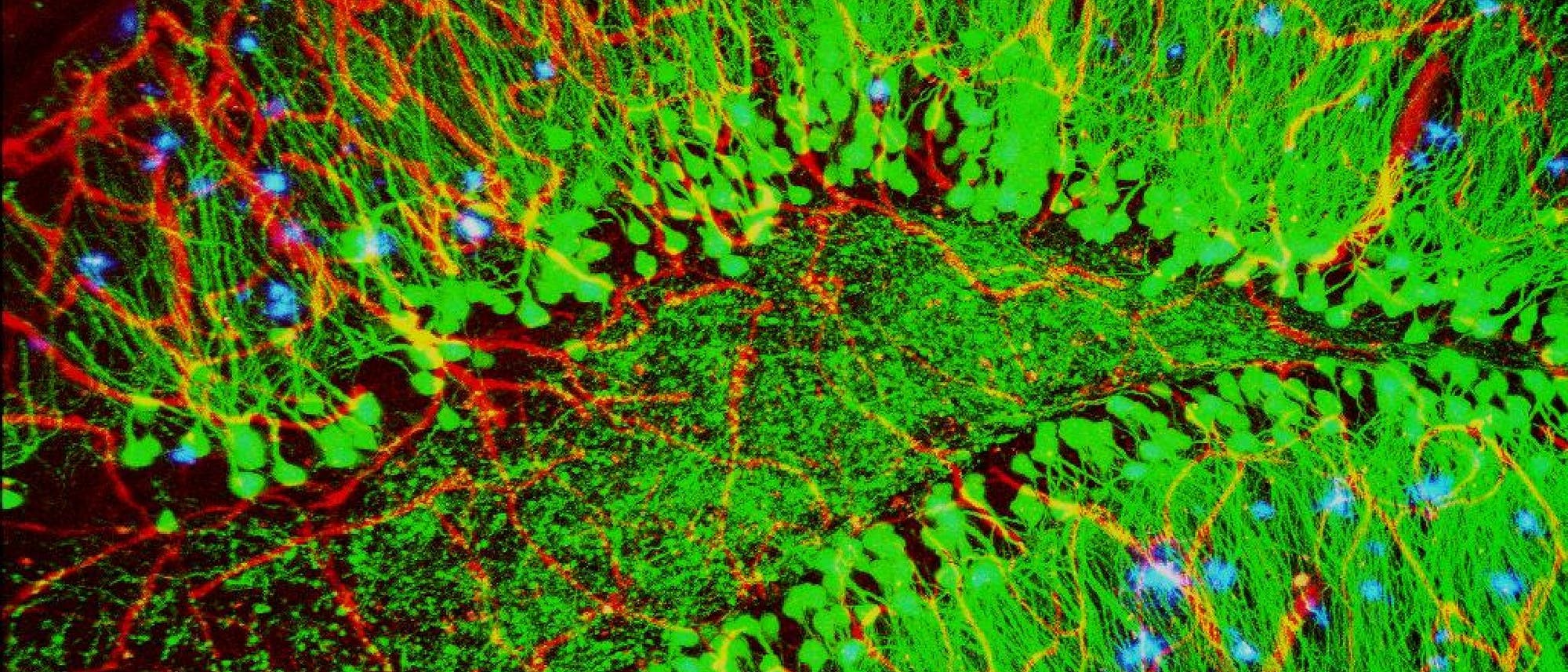 Diese Aufnahme zeigt erste Alzheimer-Plaques (blau) im Hirn einer Maus. Blutgefäße sind in rot, Nervenzellen in grün dargestellt.