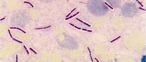 <i>Bacillus anthracis</i>