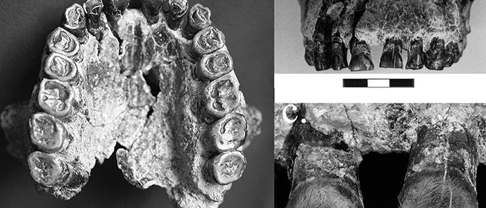 Das Fossil mit der Kennzeichnung "OH 65" aus Tansania wird einem Homo habilis zugeordnet und ist nahezu vollständig erhalten. Die Kratzer auf den Schneidezähnen sind auch nach 1,8&nbsp;Millionen&nbsp;Jahren mit bloßem Auge erkennbar und verraten etwas über die Rechtshändigkeit des Individuums.