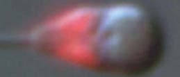 Spermienkopf mit rot gefärbten Mitochondrien