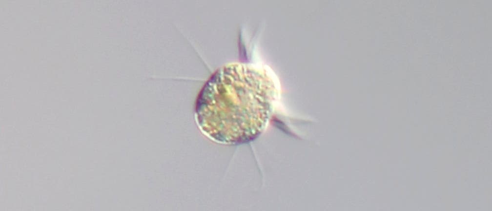 Halteria grandinella ist eine kugelige Mikrobe mit langen, fädigen Fortsätzen.