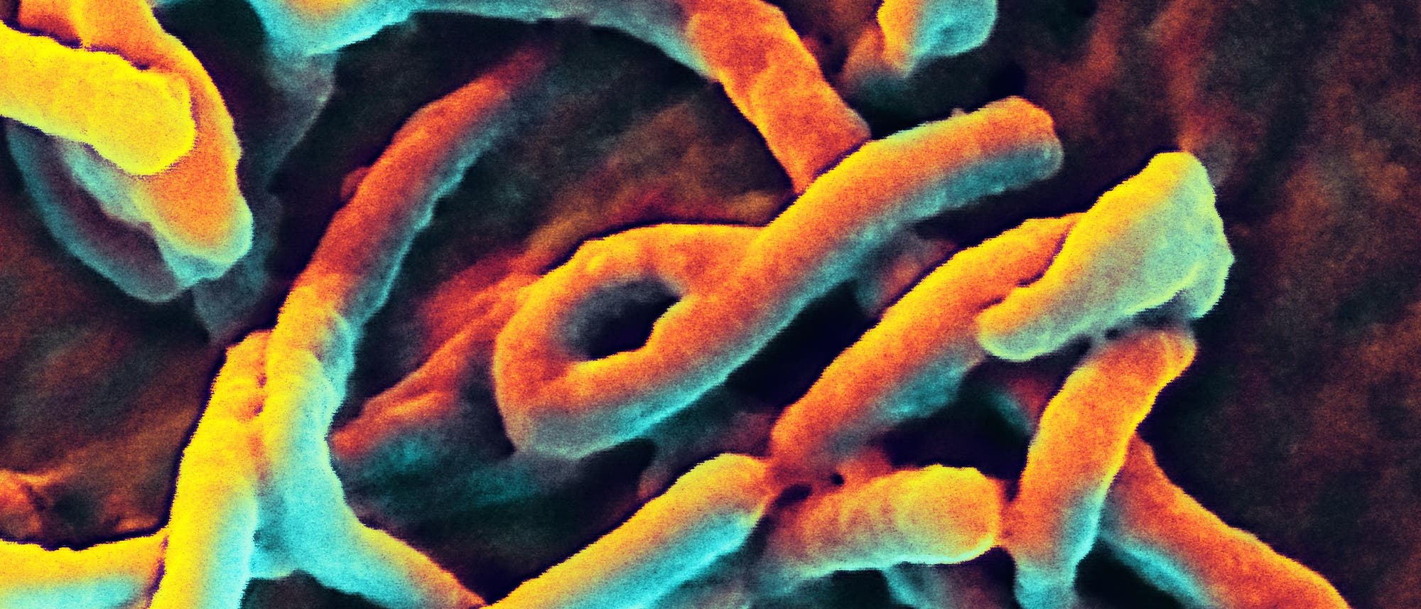 Ebolaviren