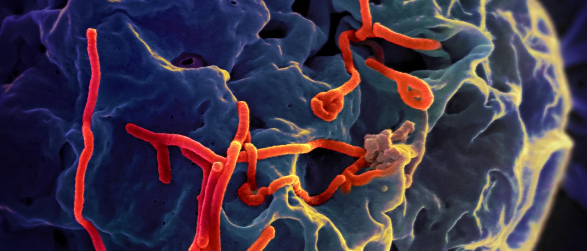 Ebolaviren in infizierter Nierenzelle