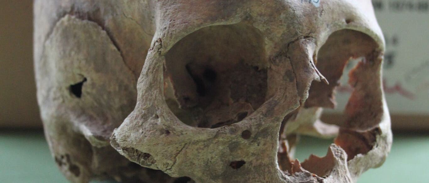 Schädel einer toten Wikingerfrau