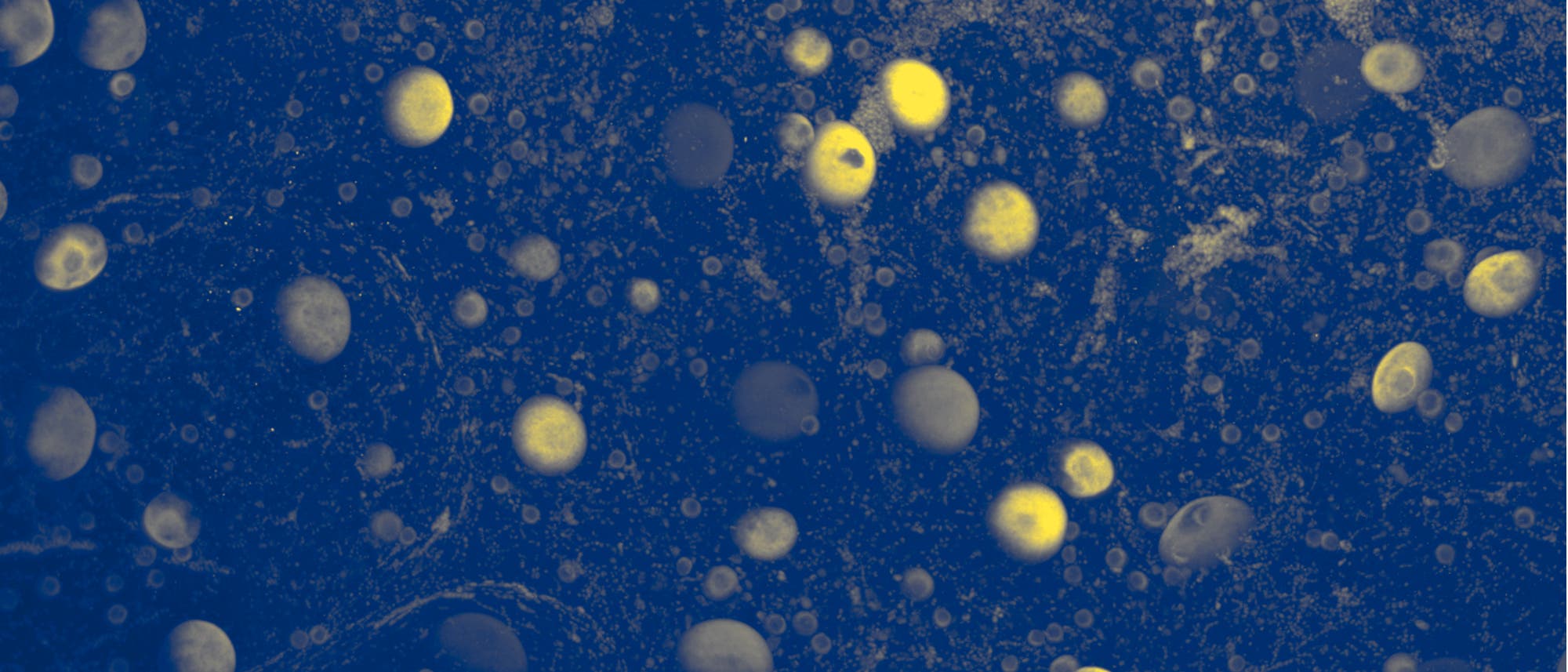 Das Bild zeigt eine fluoreszenzmikroskopische Aufnahme von Zellen. Die Zellen erscheinen als leuchtend gelbe Punkte auf einem dunkelblauen Hintergrund. Die Verteilung und Größe der Zellen variieren, was auf unterschiedliche Zelltypen oder -zustände hinweisen könnte. Die Aufnahme dient der Untersuchung zellulärer Strukturen und Prozesse. Das Bild zeigt eine fluoreszenzmikroskopische Aufnahme von Zellen. Die Zellen erscheinen als leuchtend gelbe Punkte auf einem dunkelblauen Hintergrund. Die Verteilung und Größe der Zellen variieren, was auf unterschiedliche Zelltypen oder -zustände hinweisen könnte. Die Aufnahme dient der Untersuchung zellulärer Strukturen und Prozesse.