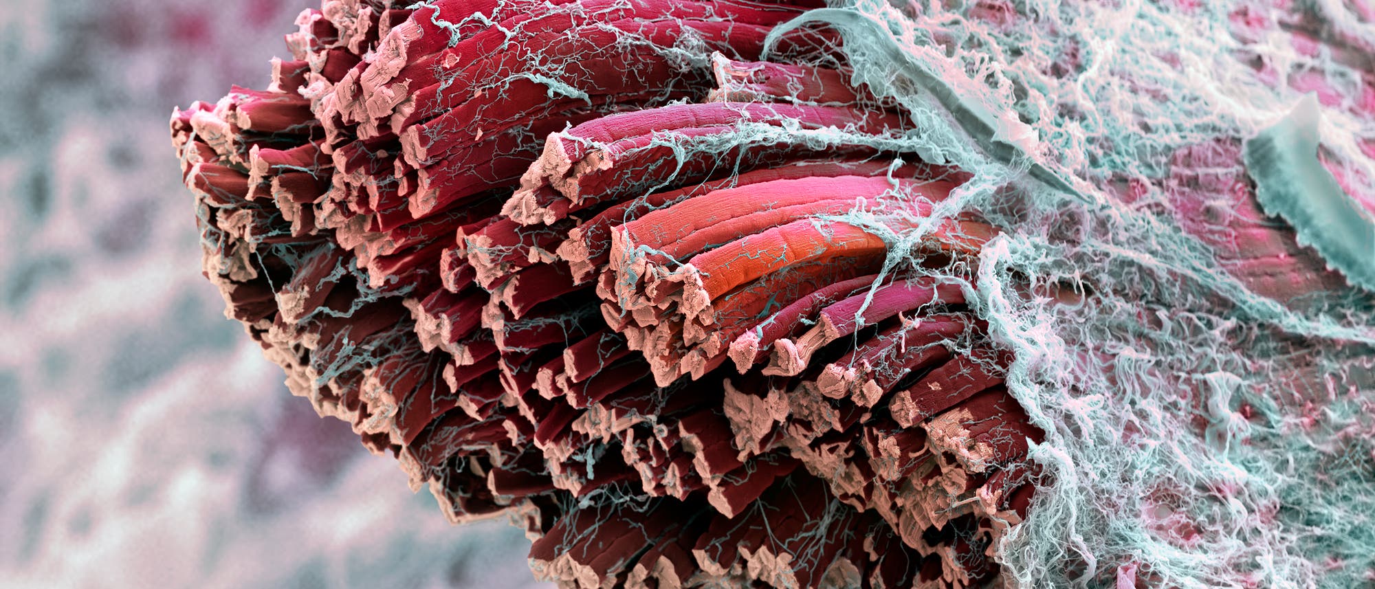Mikroskopische eingefärbte Aufnahme von Muskelfasern und Fasziengewebe