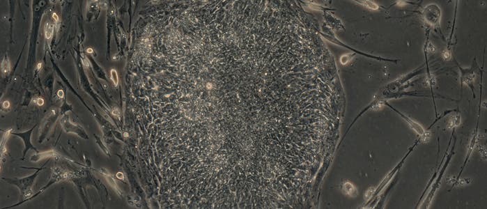 Induzierte pluripotente Stammzellen