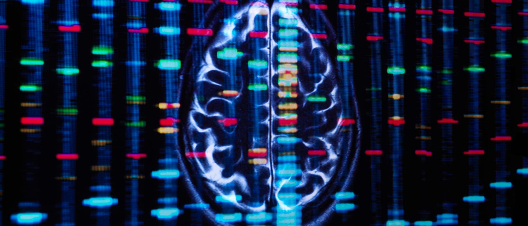 Eine wissenschaftliche Abbildung zeigt eine bioinformatische Sequenzanalyse, &uuml;berlagert mit einem MRT-Bild eines Gehirns. Die Sequenzdaten sind als bunte vertikale Linien dargestellt, die verschiedene genetische Informationen repr&auml;sentieren. Die Abbildung illustriert die Integration von Genomik und Neurowissenschaften.