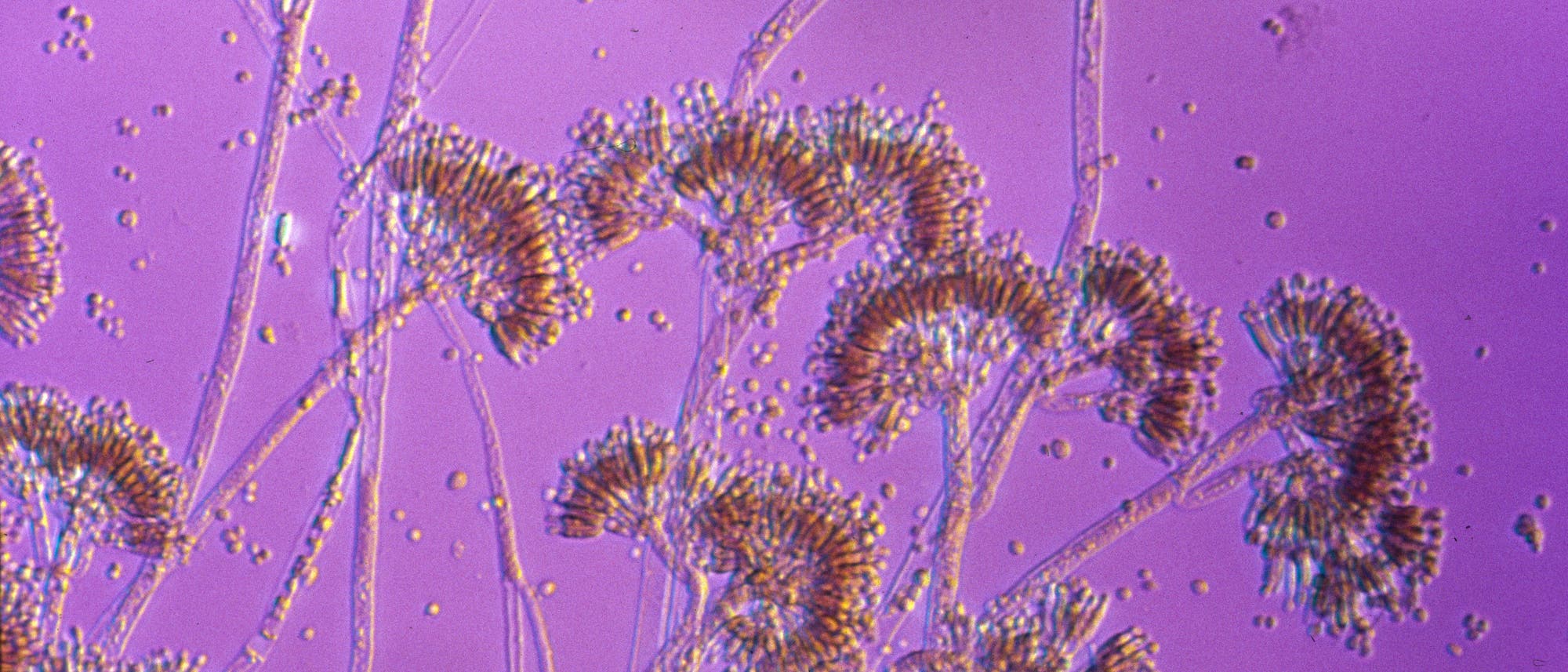 Fluoreszenzmikroskopisches Bild von Pilzstrukturen auf violettem Hintergrund. Die verzweigten Strukturen sind mit kleinen, runden Elementen &uuml;bers&auml;t. Text "dpa picture alliance" ist &uuml;ber das Bild gelegt.