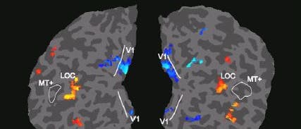 fMRI-Bilder