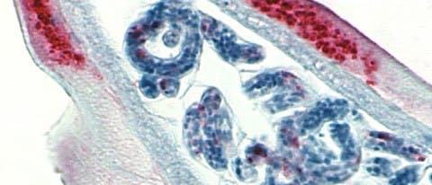 <i>Onchocerca</i> unter dem Mikroskop
