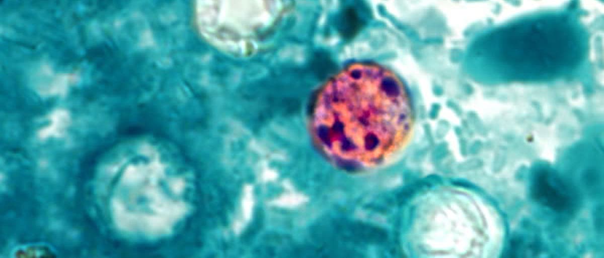 Fluoreszenzmikroskopisches Bild von Zellen, das eine kontrastreiche Darstellung zeigt. Eine Zelle in der Mitte ist in leuchtendem Rot hervorgehoben, umgeben von mehreren bl&auml;ulich-gr&uuml;nen Strukturen. Die Aufnahme hebt die Unterschiede in der Zellstruktur und -f&auml;rbung hervor, was auf spezifische biologische oder chemische Prozesse hinweisen k&ouml;nnte.