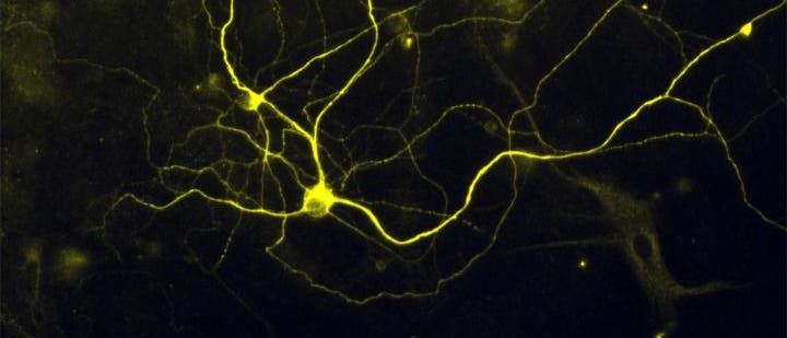 Induzierte sensorische Neurone