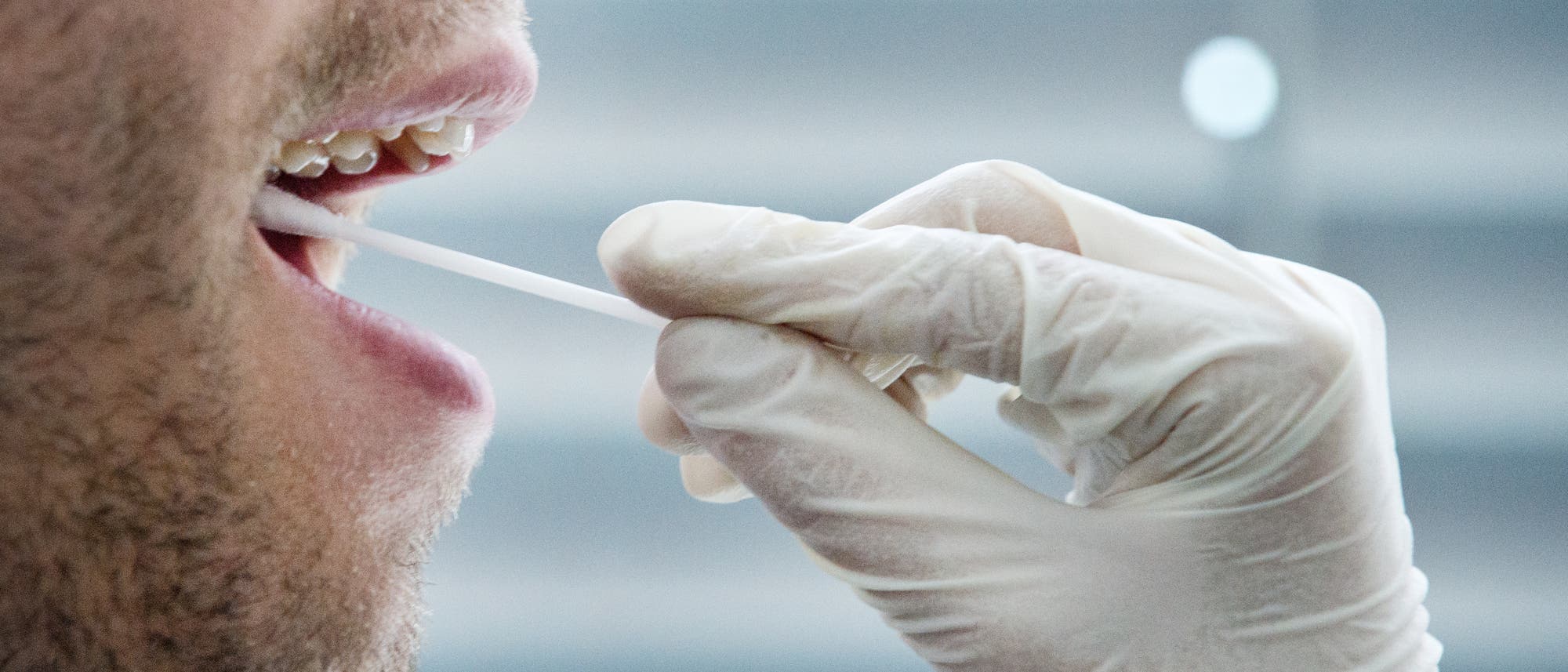 Einem potenziellen Stammzelspender wird mit einem Wattestäbchen eine Probe aus dem Mund entnommen
