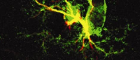 Radialgliazellen bilden neuronale Stammzellen