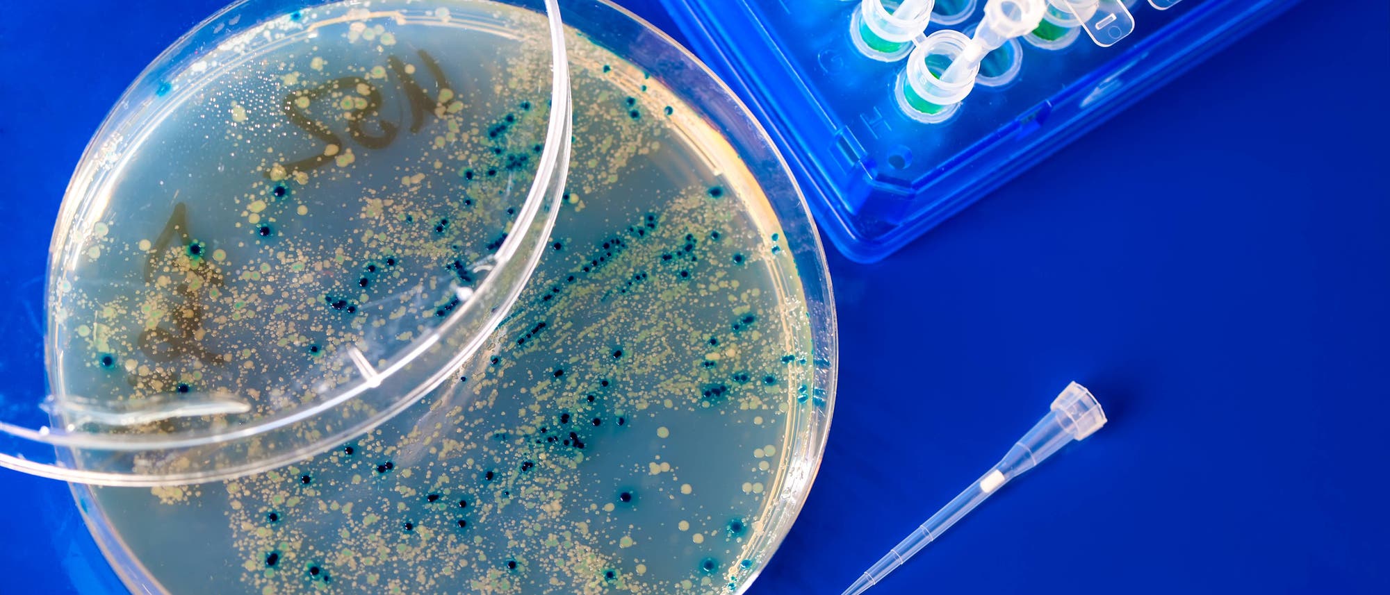 Eine Petrischale mit einer blauen und gelben Bakterienkultur auf einem blauen Hintergrund. Daneben befindet sich eine Pipettenspitze und ein Rack mit mehreren Reagenzgläsern. Die Szene zeigt ein typisches Labor-Setup für mikrobiologische Untersuchungen.
