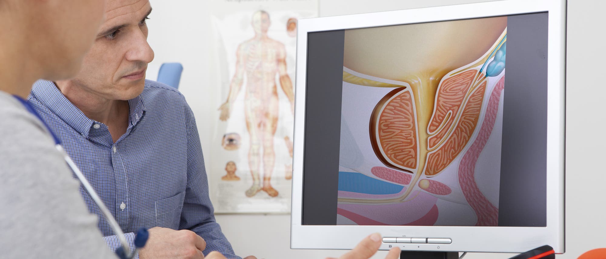 Eine Ärztin erklärt einem Patienten die Prostata anhand einer Illustration.