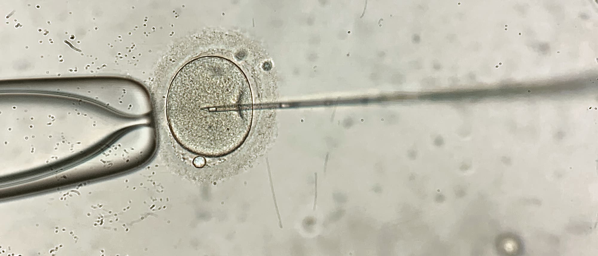Ein Mikroskopbild zeigt eine In-vitro-Fertilisation (IVF), bei der eine feine Nadel in eine menschliche Eizelle eingeführt wird.