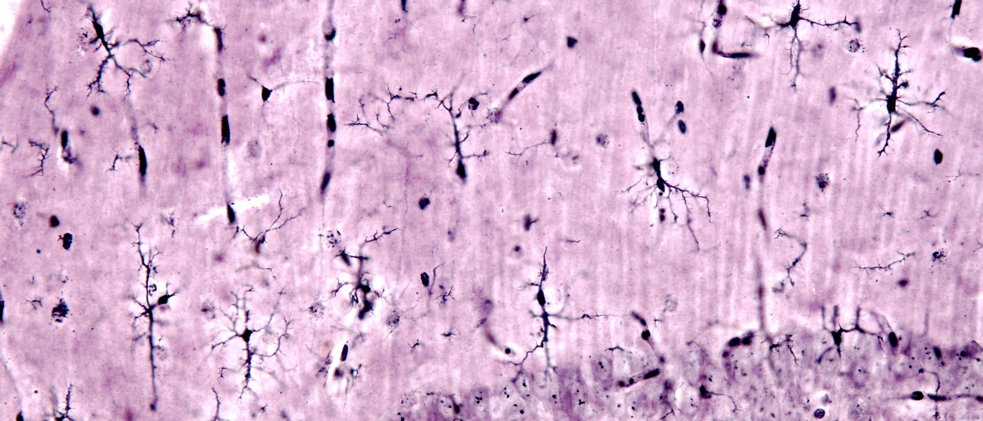 Mikroskopisches Bild von einem Hirngewebeschnitt aus dem Hippocampus. Die Abbildung zeigt stark sternförmig verzweigte, dunkel eingefärbte Zellen im gesamten Gewebe, die die Mikroglia darstellen. Mikroskopisches Bild von einem Hirngewebeschnitt aus dem Hippocampus. Die Abbildung zeigt stark sternförmig verzweigte, dunkel eingefärbte Zellen im gesamten Gewebe, die die Mikroglia darstellen.