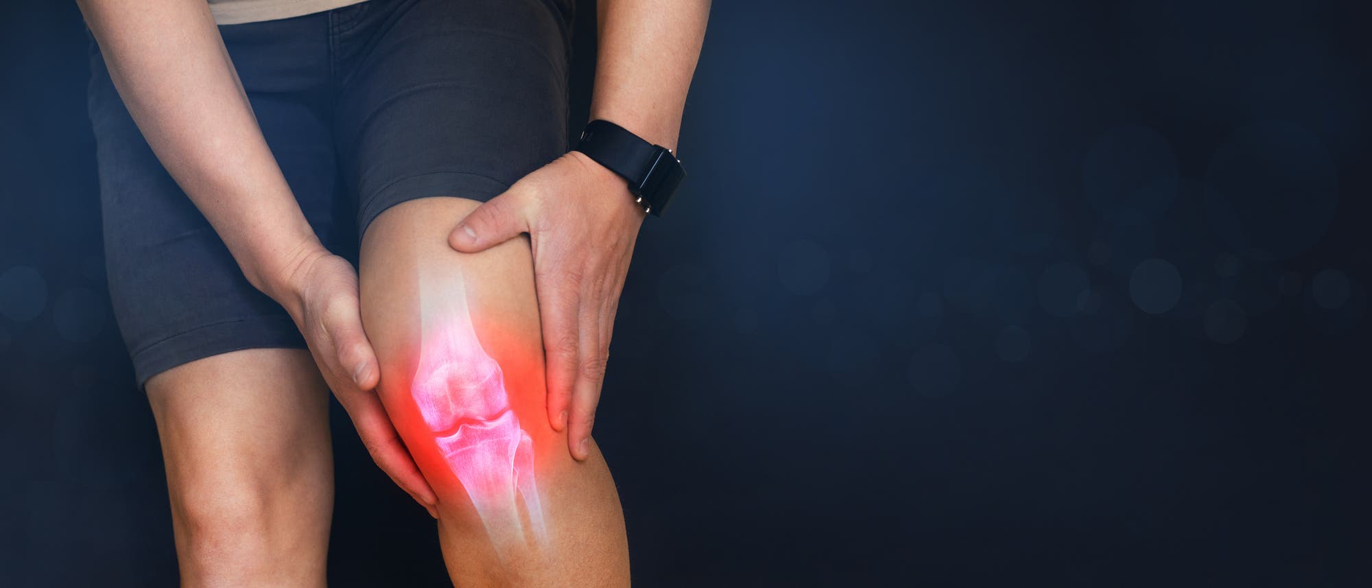 Eine Person hält ihr schmerzendes Knie, das durch eine rote Markierung hervorgehoben ist. Ein anatomisches Diagramm des Kniegelenks ist über dem Bein eingeblendet, um die Position des Schmerzes zu verdeutlichen. Die Person trägt eine dunkle Shorts und eine Uhr am Handgelenk. Der Hintergrund ist dunkel und unscharf.