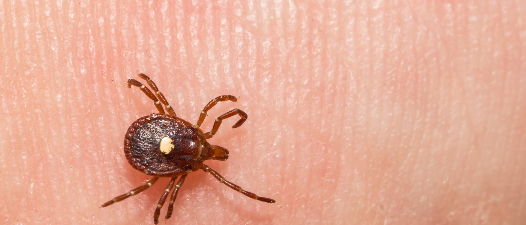 Eine winzige braune Zecke mit einem weißen Punkt am Hinterteil, die auf dem Finger einer Person sitzt